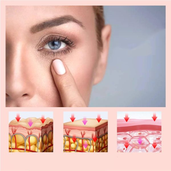 Eye bags beauty equipment - Image 3